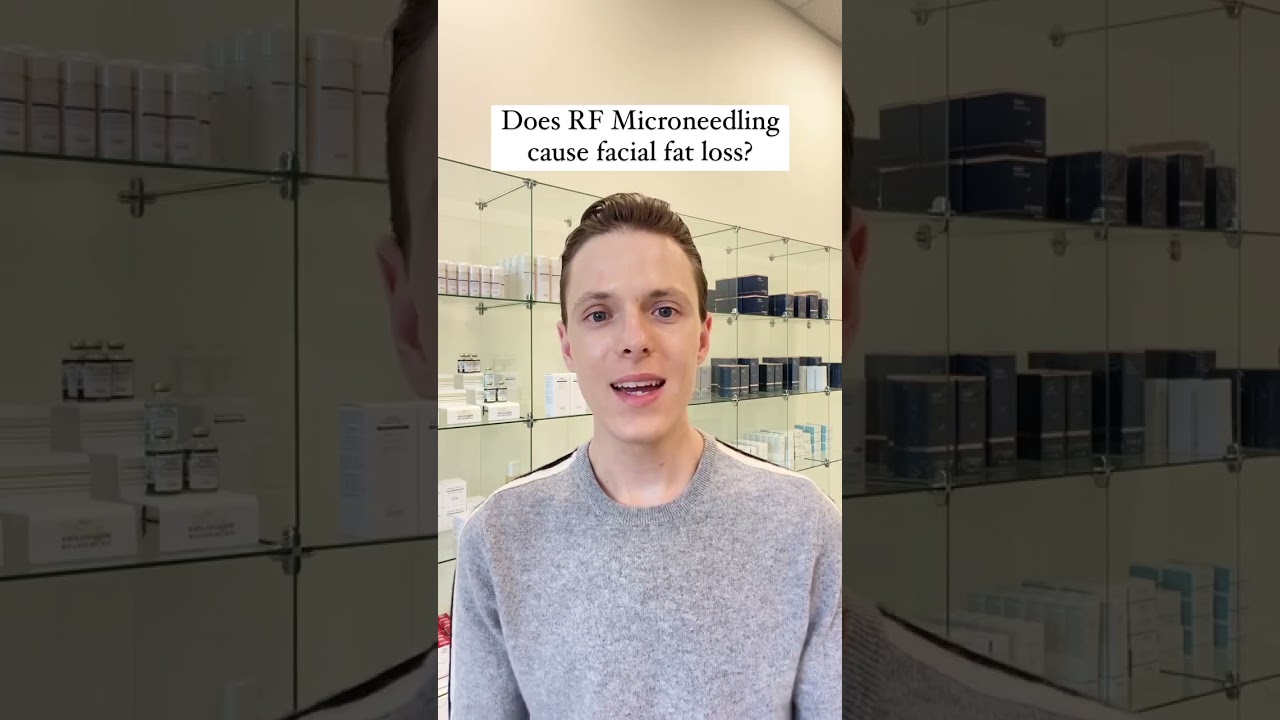 Does RF Microneedling cause facial fat loss?