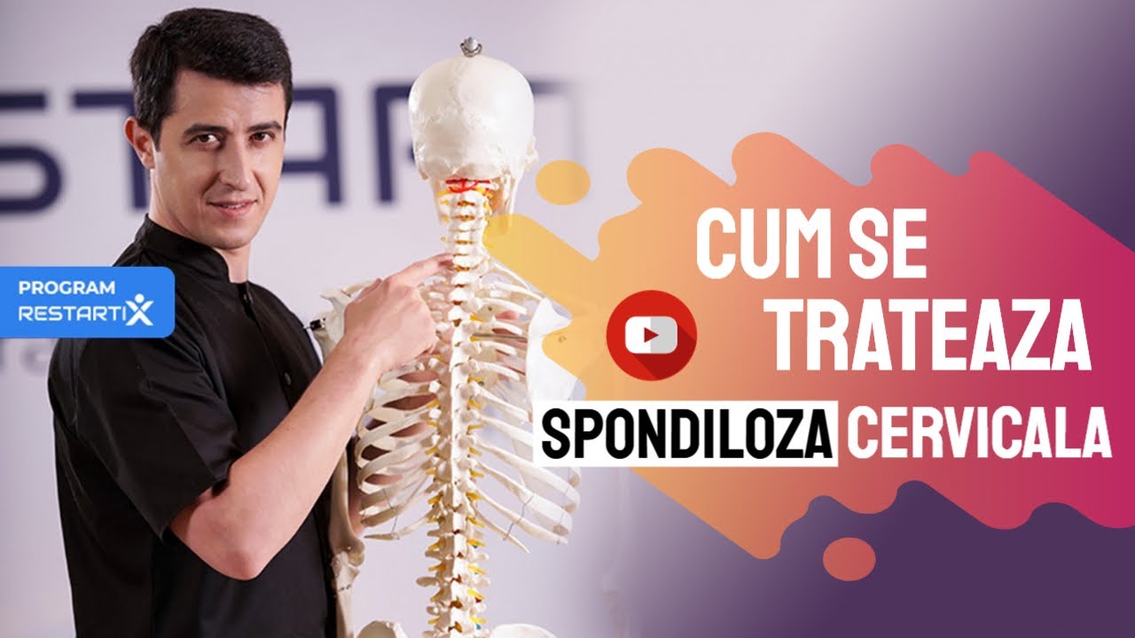 KINETOTERAPIE I Spondiloza Cervicala ? CAUZE, SEMNE CLINICE, RECOMANDARI I Alexandru Ilie, RestartiX
