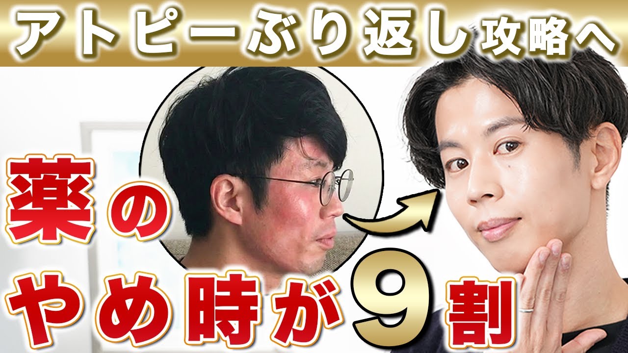 アトピーの塗り薬、いつやめる？9割が間違う「正しい減らし方」とアトピー改善・卒業ロードマップ【2026最新】
