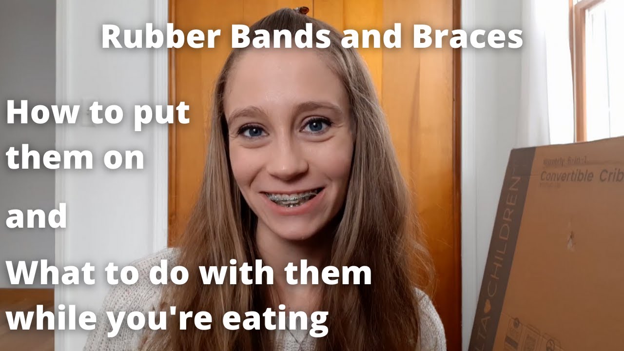 Rubber Bands and Braces: How I put mine on and what to do with them while eating