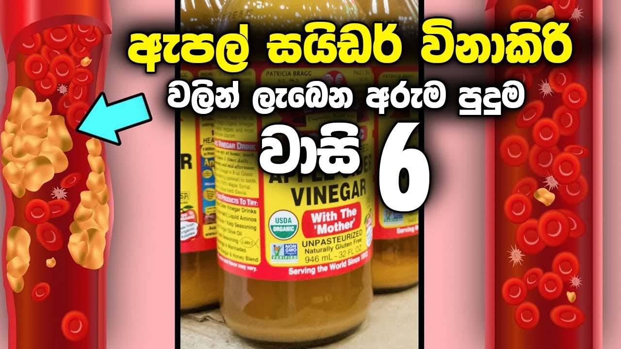 ඇපල් සයිඩර් විනාකිරි වලින් ලැබෙන අරුම පුදුම වාසි 6ක් මෙන්න - Apple Cider Vinegar Health benefits