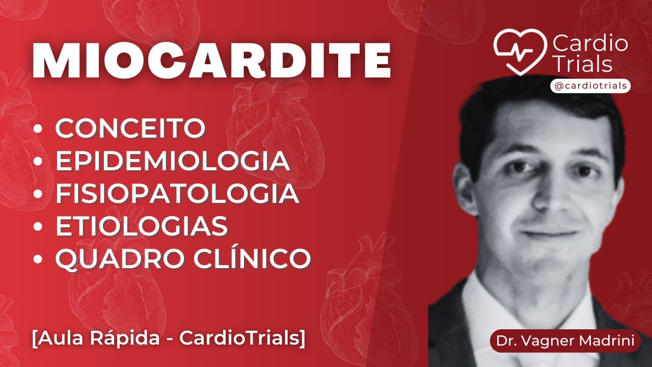 MIOCARDITE: Conceito, Epidemiologia, Fisiopatologia, Etiologias e Quadros Clínicos [AULA COMPLETA]