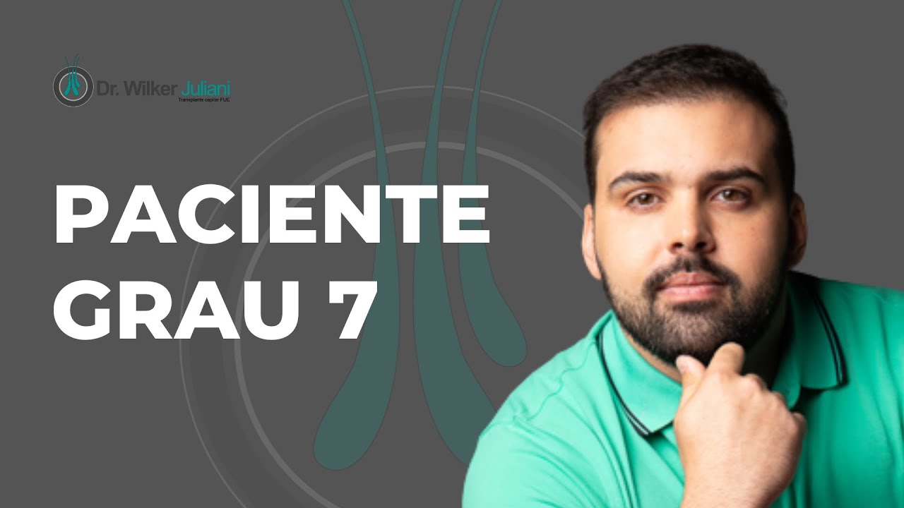Paciente com calvície grau 7
