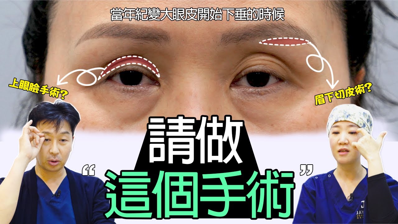 當眼皮下垂時，上眼瞼 VS 眉下切皮術 |最近哪個流行？