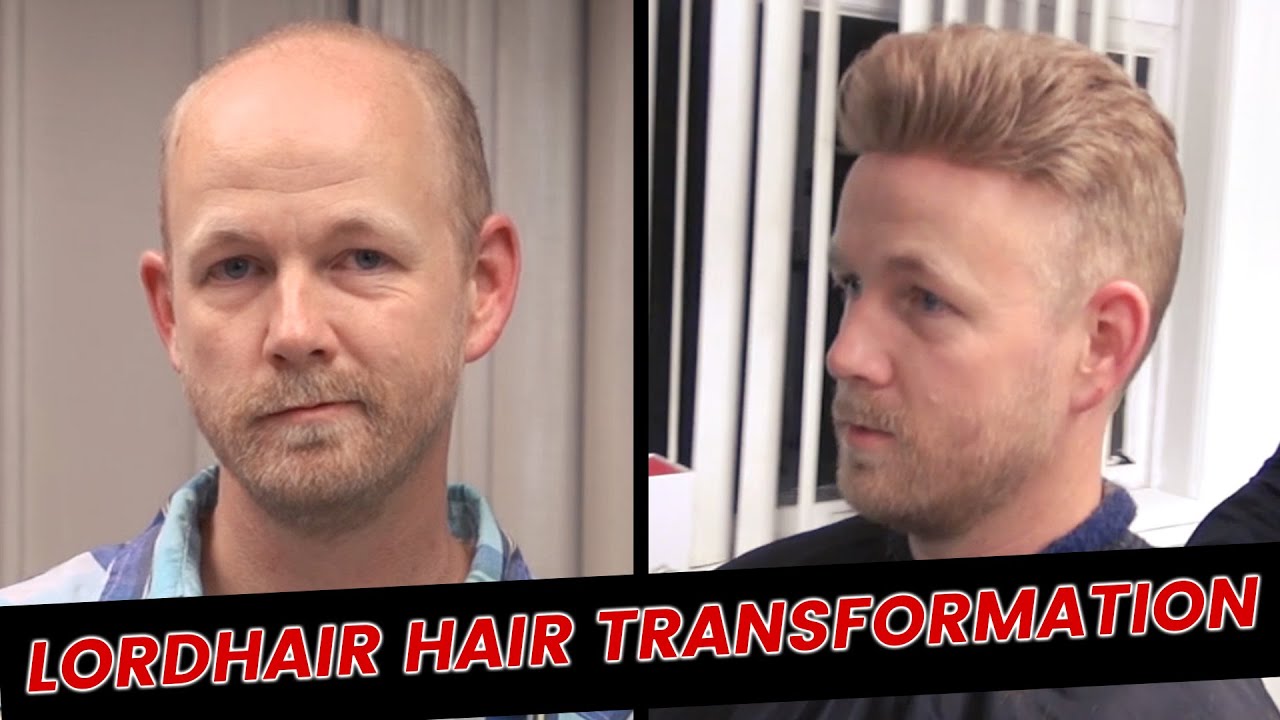 Lordhair Hair Transformation | Lordhair Men’s Hair Systems