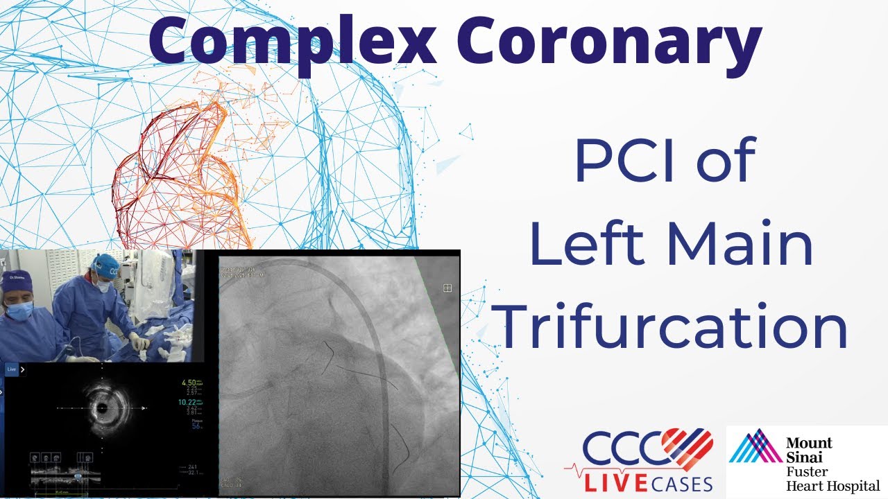 PCI of Left Main Trifurcation