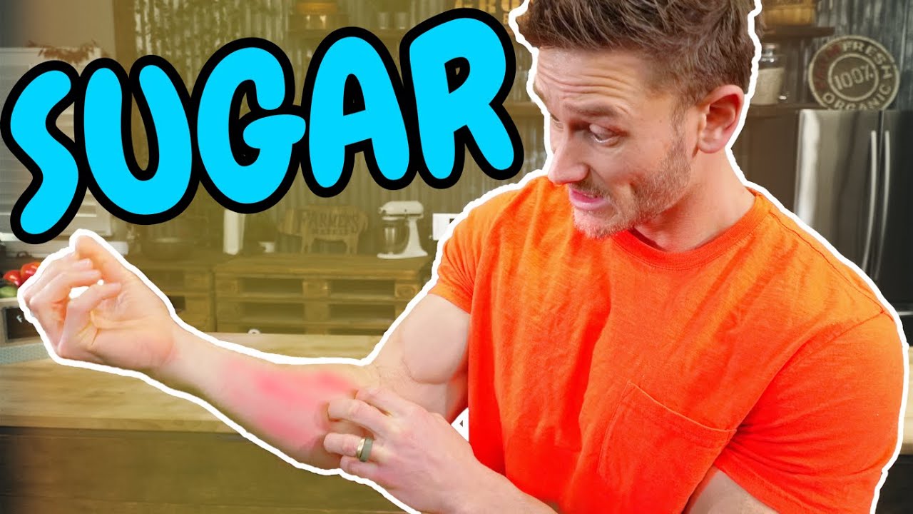 THIS is What Eating SUGAR Does to Your Skin!