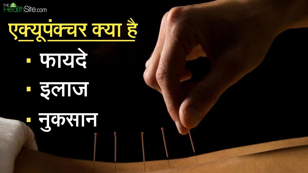 World Acupuncture Day 2022: एक्यूपंचर क्या है? जानें इस विधि के कुछ फायदे और नुकसान, Watch Video