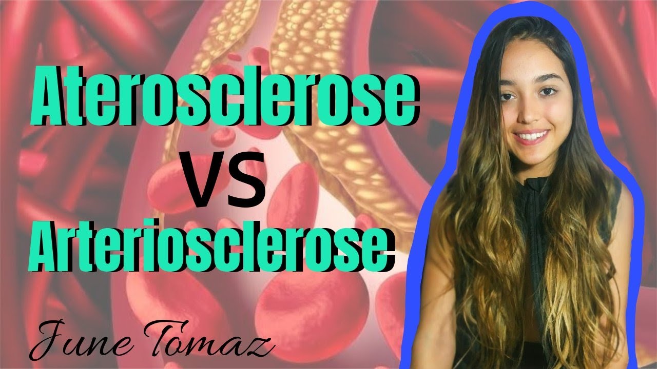 ATEROSCLEROSE VS ARTERIOSCLEROSE