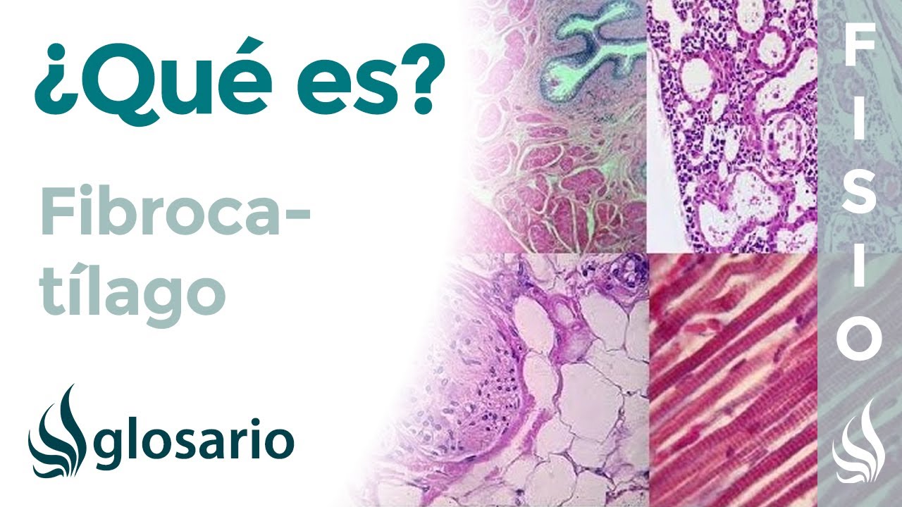 FIBROCART&Iacute;LAGO | Qu&eacute; es, componentes, ubicaci&oacute;n y funci&oacute;n