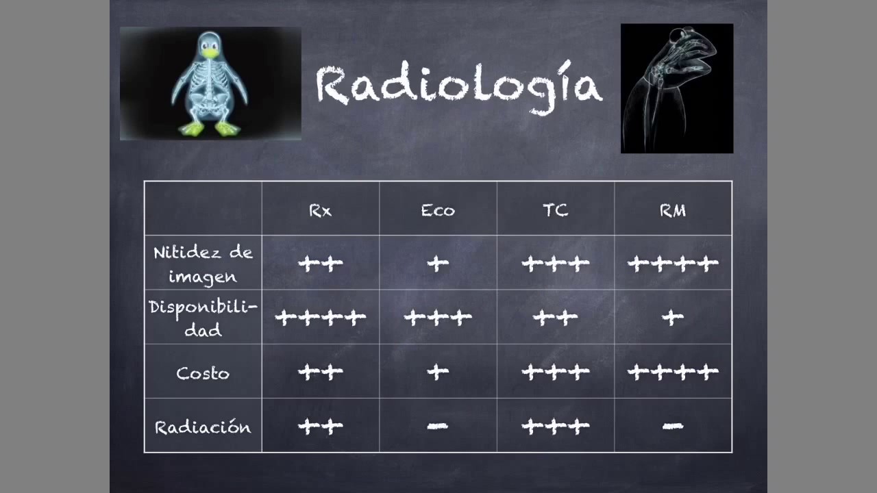 Introducci&oacute;n a la Tomograf&iacute;a Computarizada