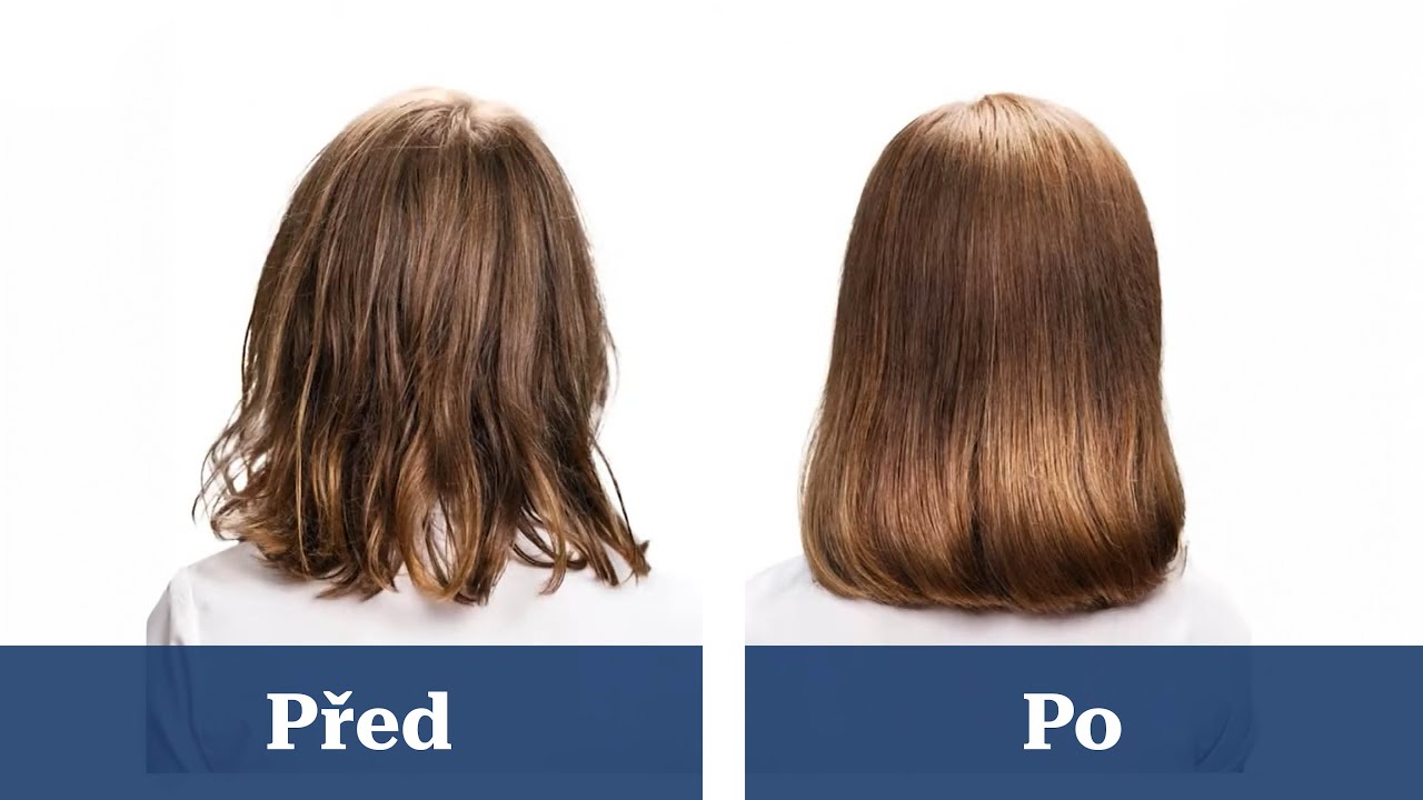 Trichologick&eacute; vy&scaron;etřen&iacute; vlasů na klinice Medical Institut v Plzni