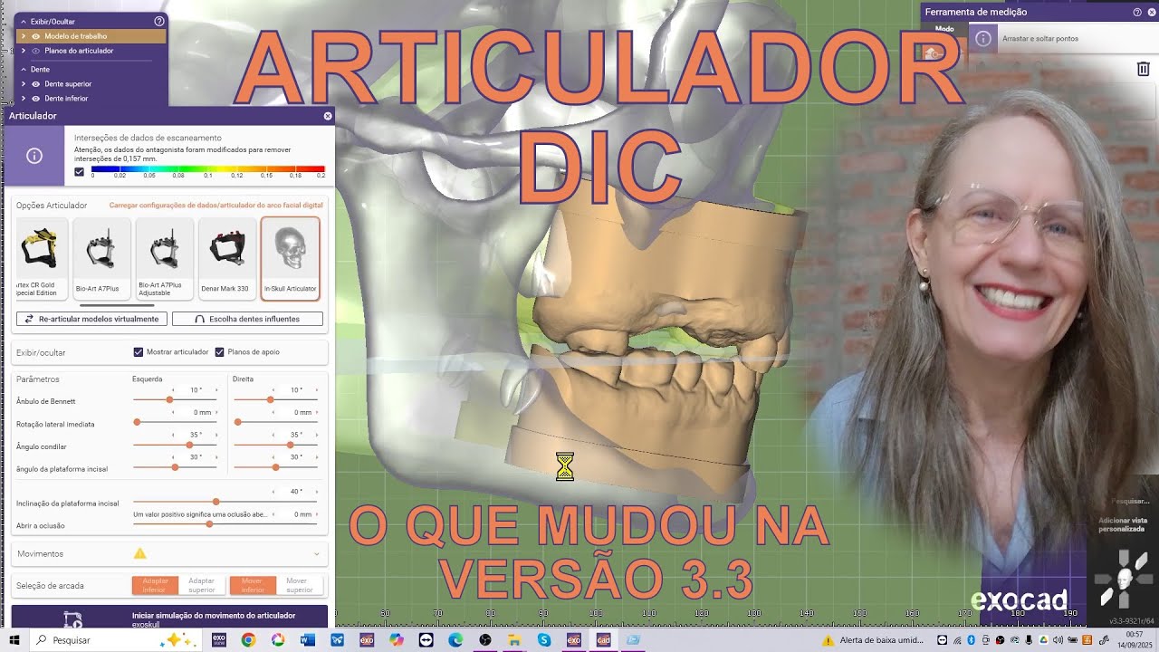 📢Articulador Virtual o que mudou na versão 3.3 Chemnitz #exocad #montagemdedentes #protesetotal #ppr