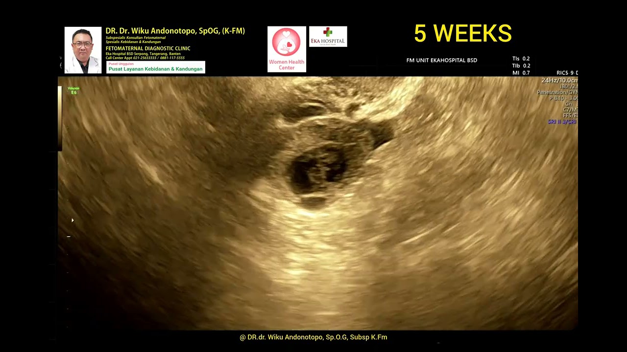 Perkembangan mingguan hamil muda usia 4 - 6 weeks
