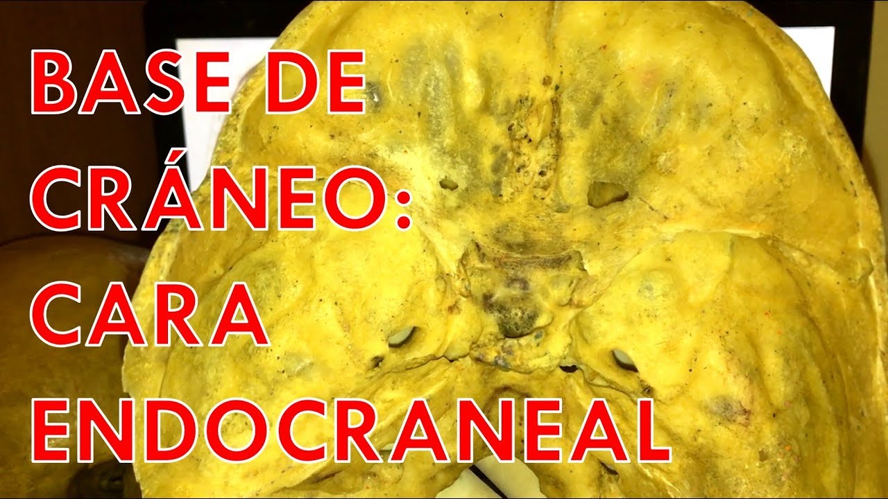 Anatomía - Base Endocraneal (Fosas Craneales Anterior, Media y Posterior)