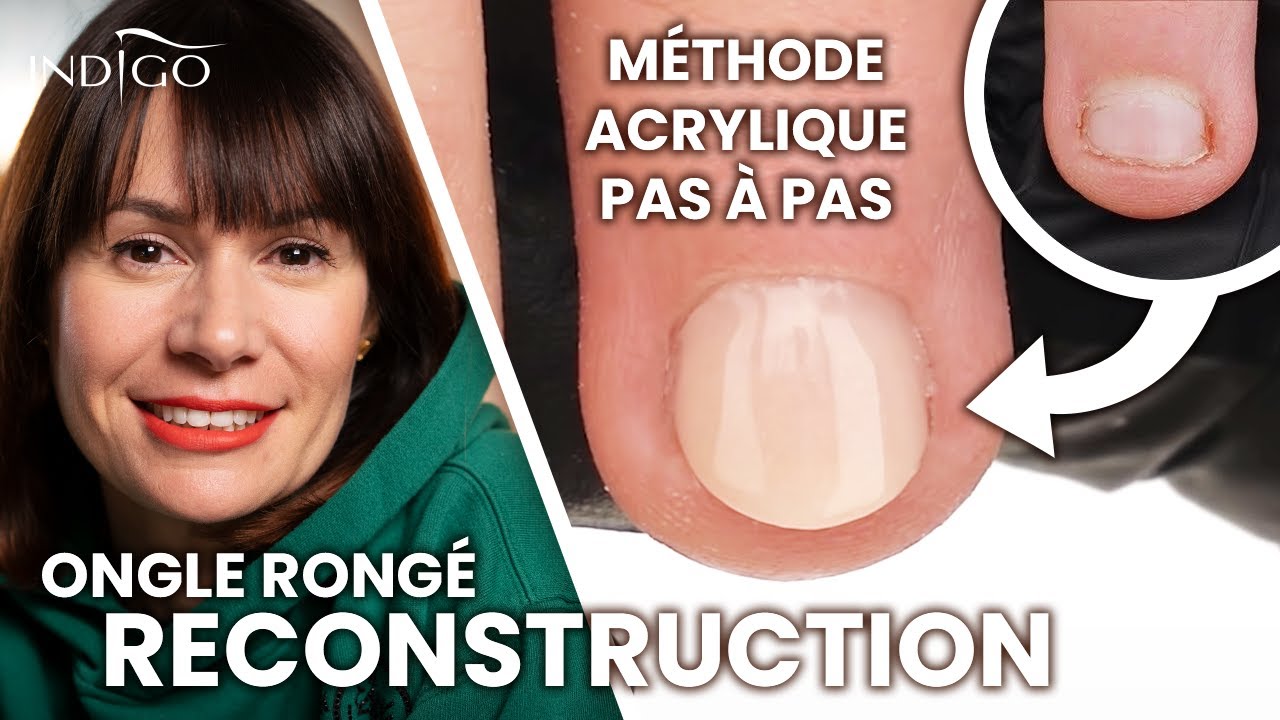 Comment faire la reconstruction de l'ongle rongé - tuto acrylique ongle  | Indigo Nails Français