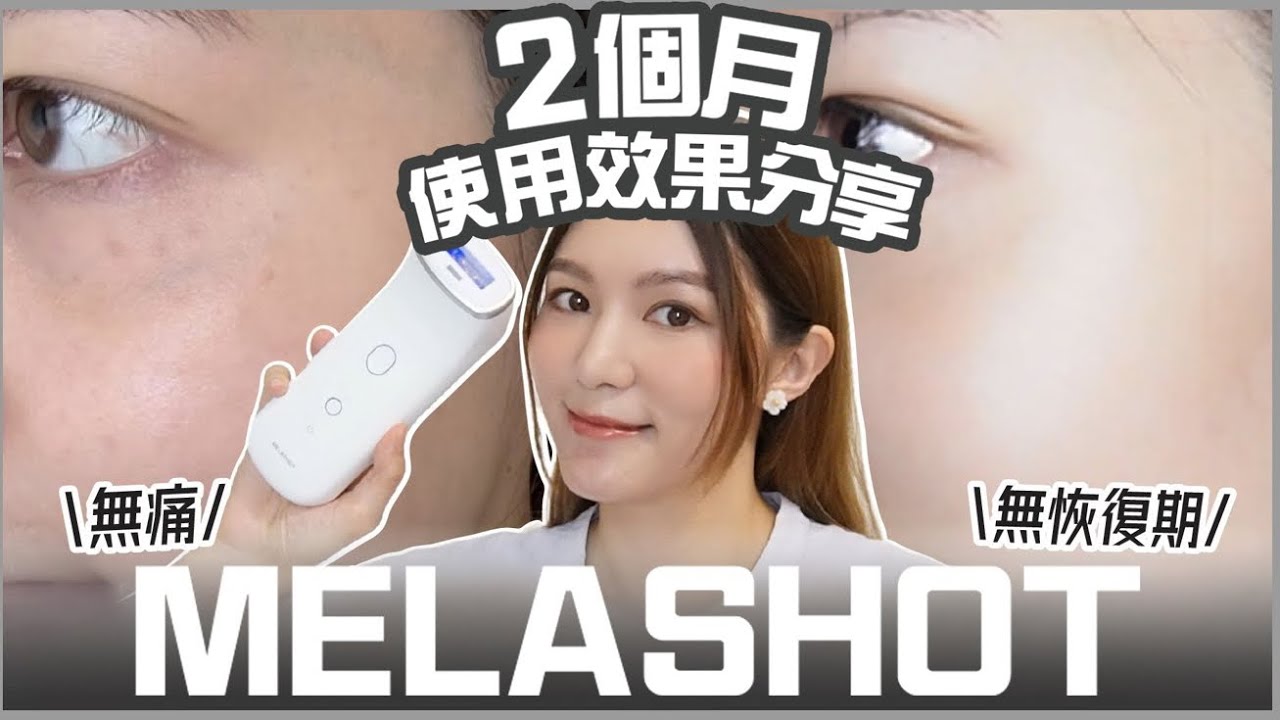 【2個月實測分享】在家打斑2個月?! 有效果嗎?! 無痛無恢復期無反黑❓｜全韓國香港首部😍居家打斑美容儀💥｜Tiffany Lhy 李珝溰 #美容儀 #去斑 #Melashot #實測