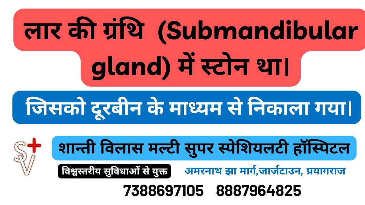 Pratishta Maurya की लार की ग्रंथि Submandibular gland में स्टोन था। जिसको दूरबीन के माध्यम से निकाला
