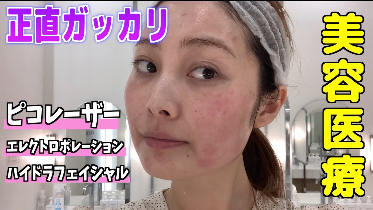 【美容医療】効いたもの・効かなかったもの正直レビュー✨ピコレーザー｜ハイドラフェイシャル｜エレクトロポレーション