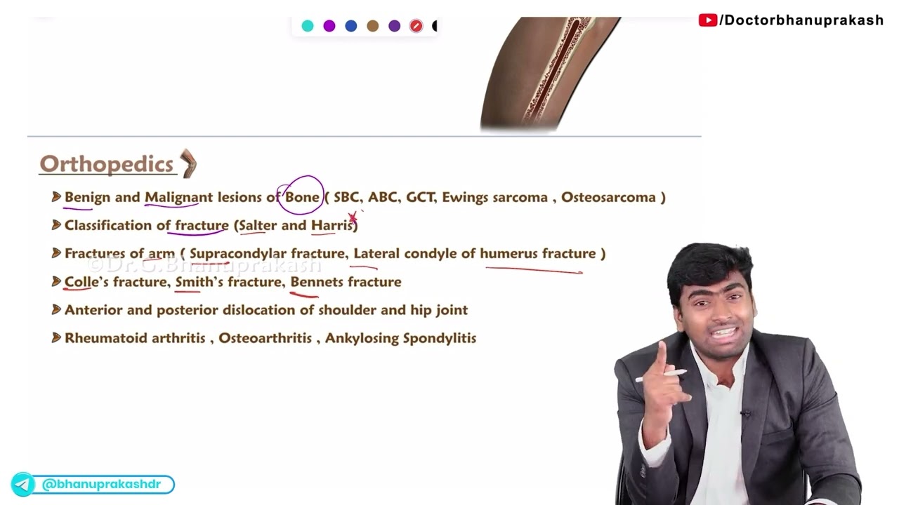 CRACK FMGE : Most important topics from Orthopedics