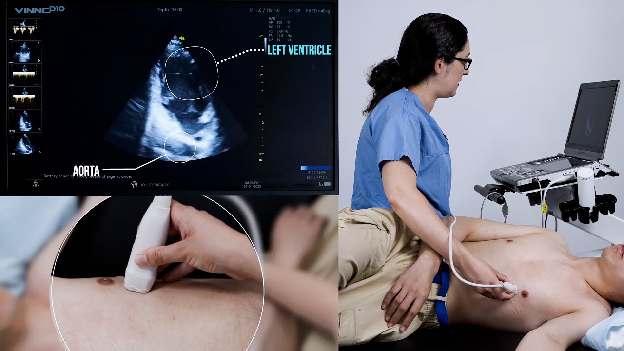 How to perfect the apical 2 chamber view
