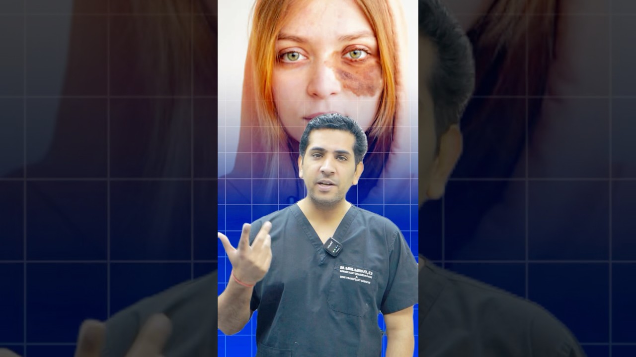 Is there any side effect of laser on face?? 