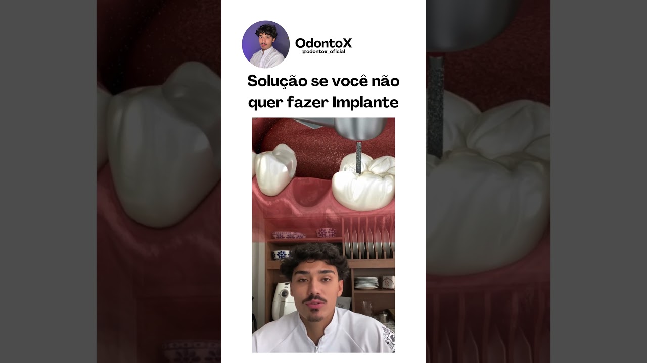 Solu&ccedil;&atilde;o para voc&ecirc; que n&atilde;o quer fazer implantes dent&aacute;rios