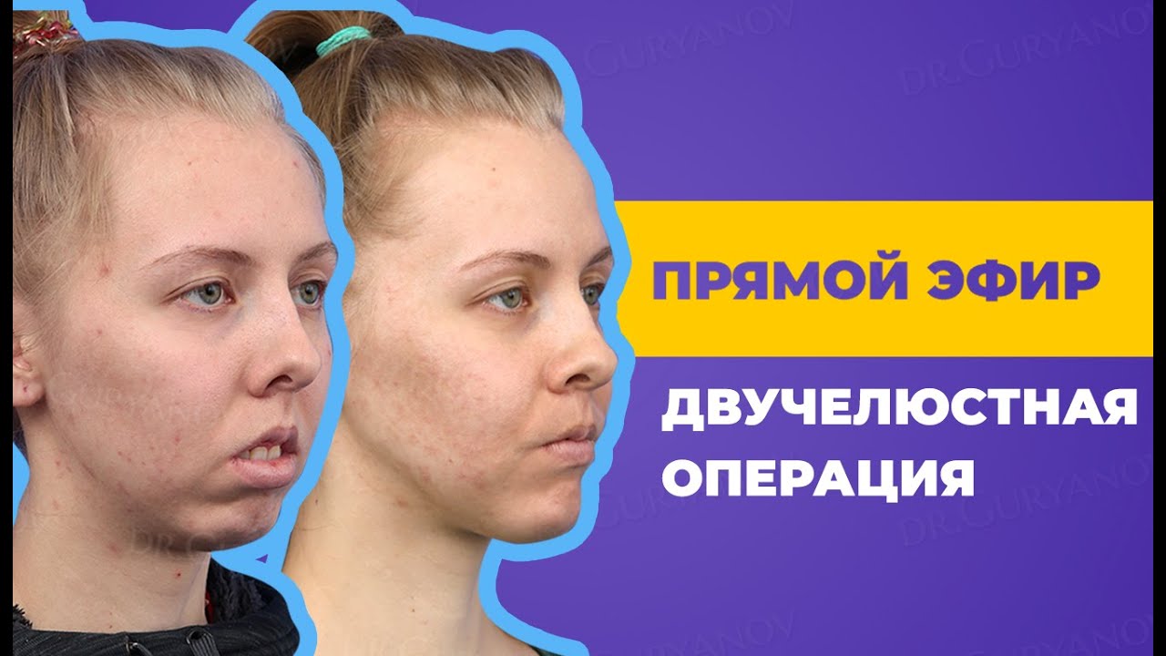 Запись прямого эфира. Роберт Андреевич Гурьянов, пластический и челюстно-лицевой хирург.