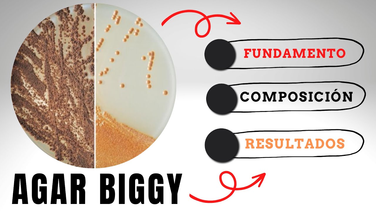 AGAR BISMUTO GLUCOSA GLICINA LEVADURA | AGAR BIGGY | MEDIOS DE CULTIVO EN MICROBIOLOGÍA | BIGGY AGAR