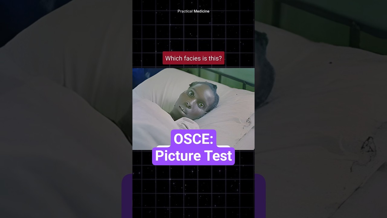[OSCE: Test obrazkowy] Co to za twarz?