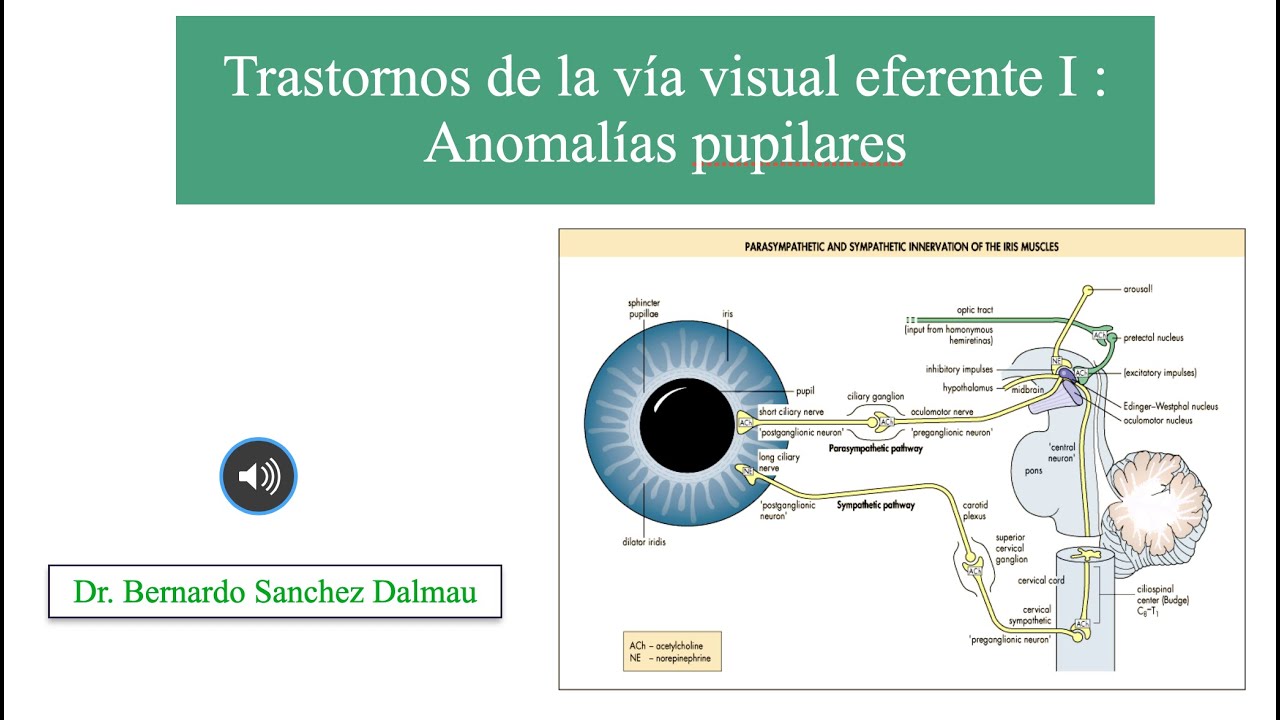 Trastornos de la Vía Visual Eferente I. Anomalías Pupilares.