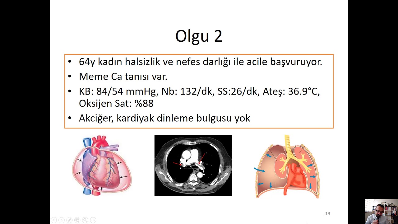 AS'de şok hastasına yaklaşım