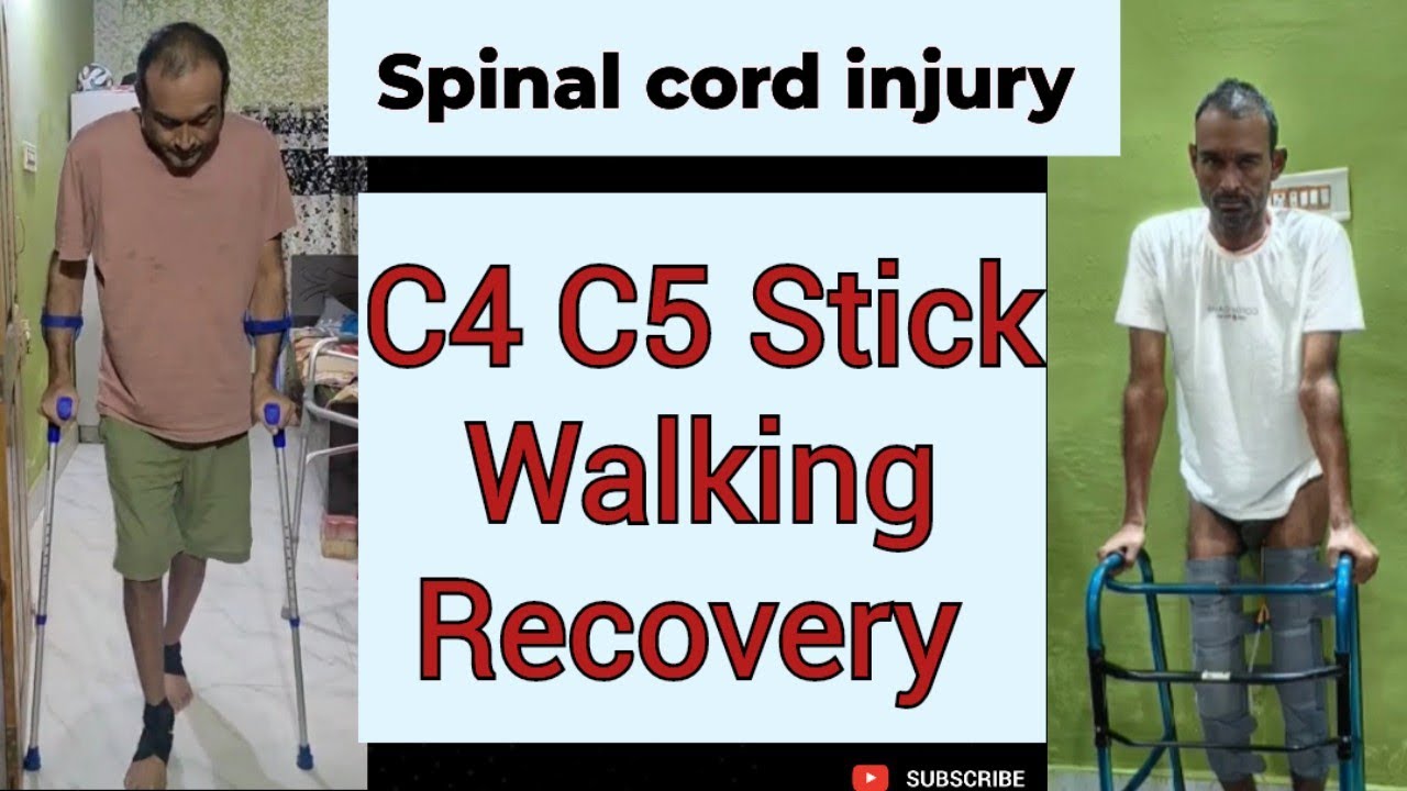 Cervical Patient Walking With Stick #spinalcordinjury #explore #viral