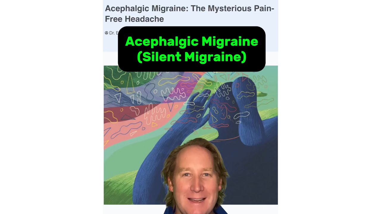 Acephalgic Migraine (Silent Migraine): The Mysterious Pain-Free Headache. 