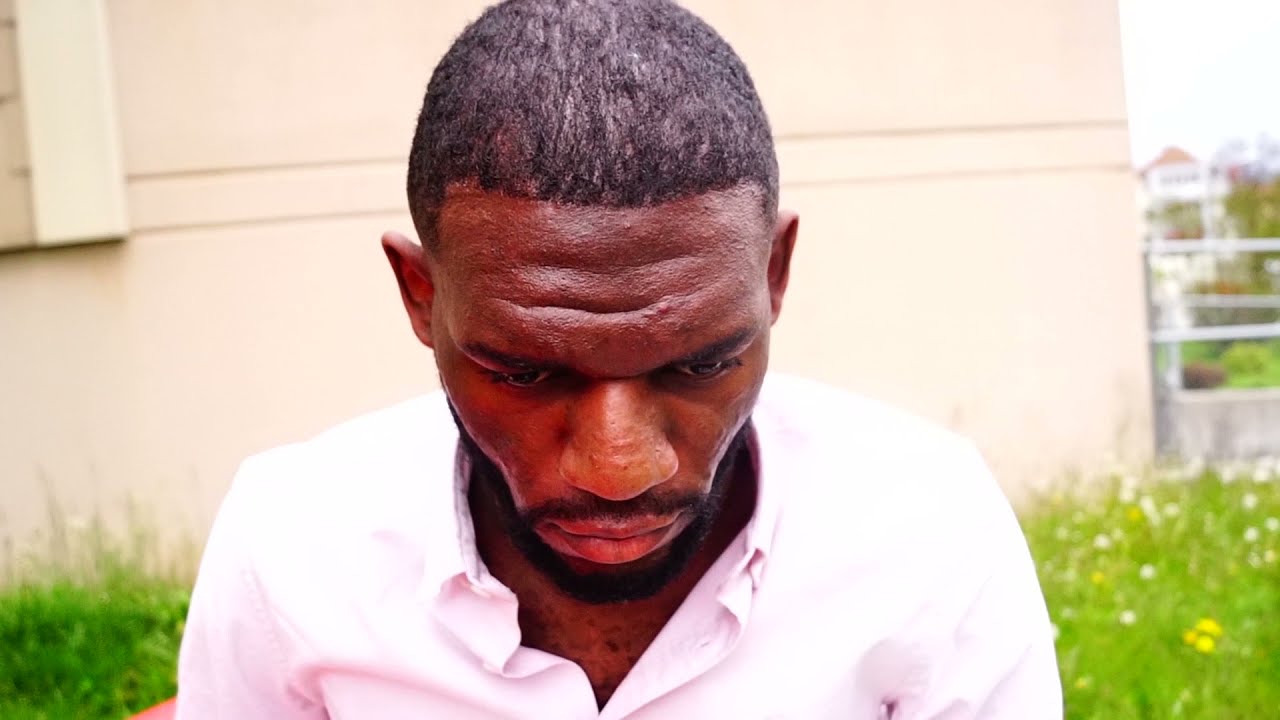 Greffe afro après 10 mois mon opinion