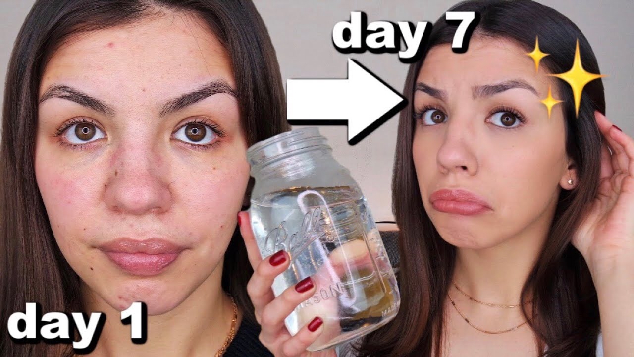 I Drank A Gallon Of Water A Day For One Week | Before And After Results