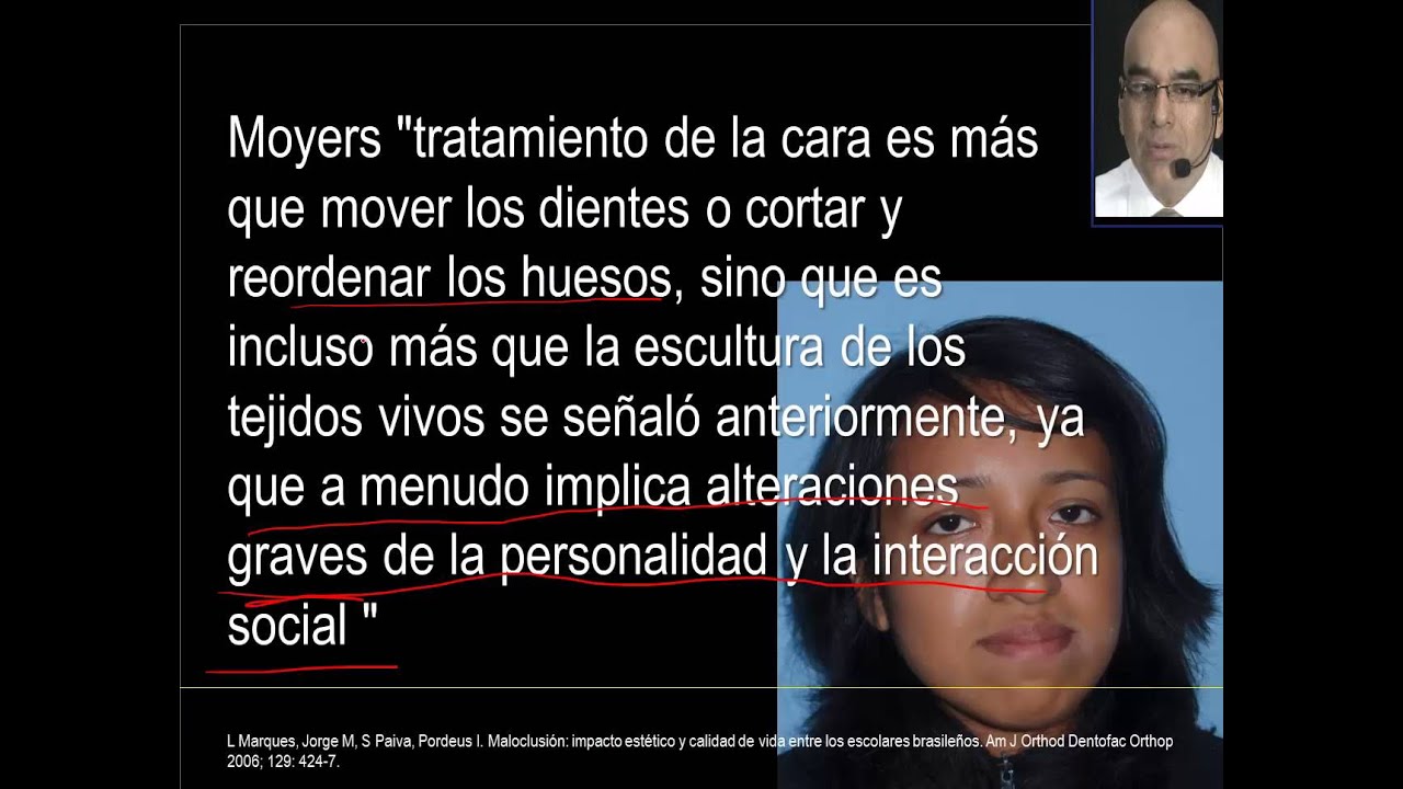 Camuflaje en Clase III con Extracción de Caninos Inferiores Parte II ( 7-23 )