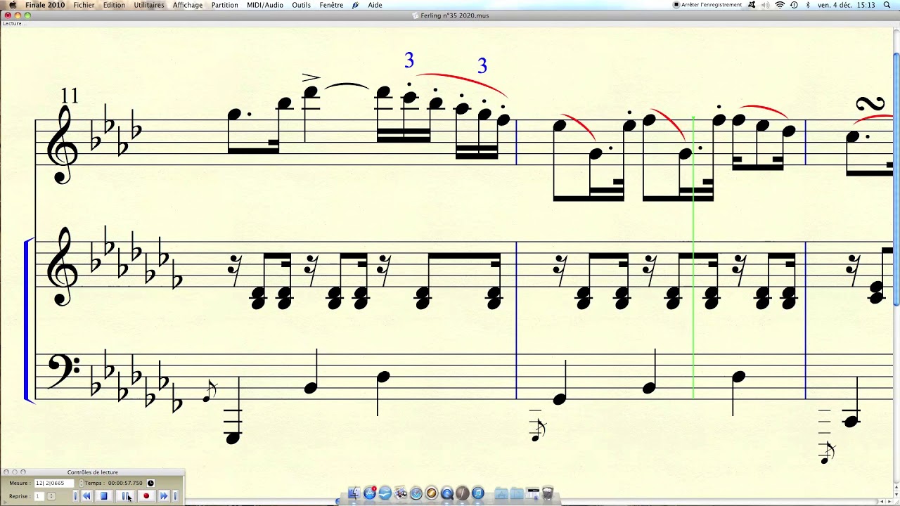 Projet FERLING Etude n°35