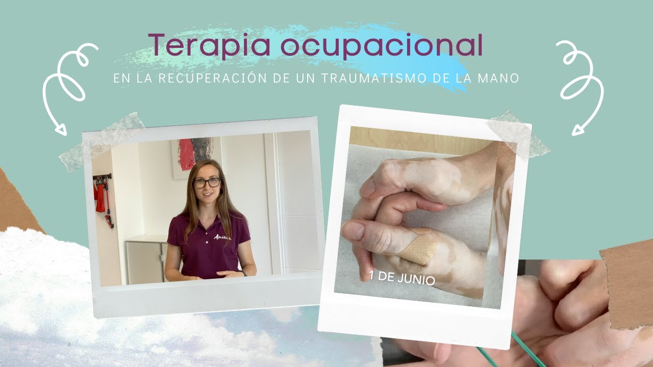 Terapia ocupacional en la rehabilitación de un traumatismo de la mano