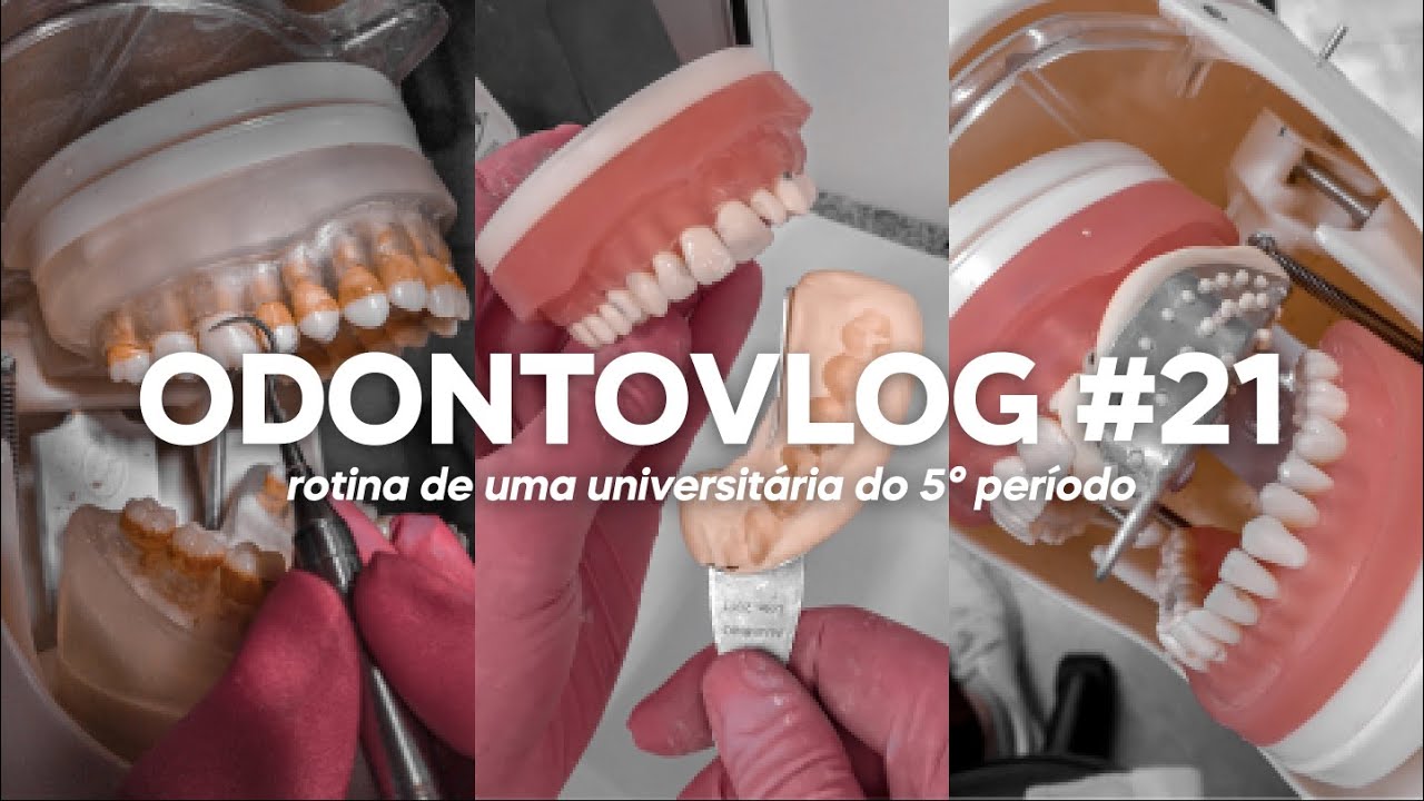 ODONTOVLOG #21: uma semana prática: perio, dentística e prótese | Odonto Energy