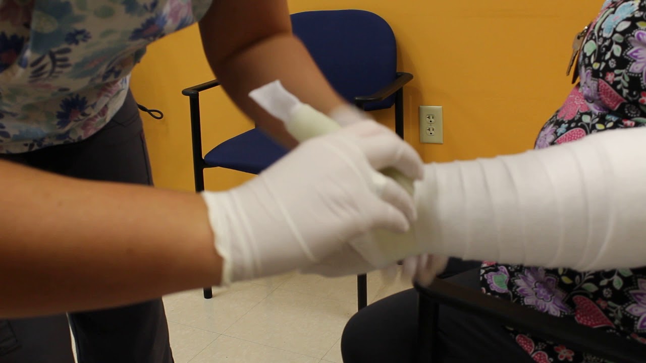Thumb Spica Cast