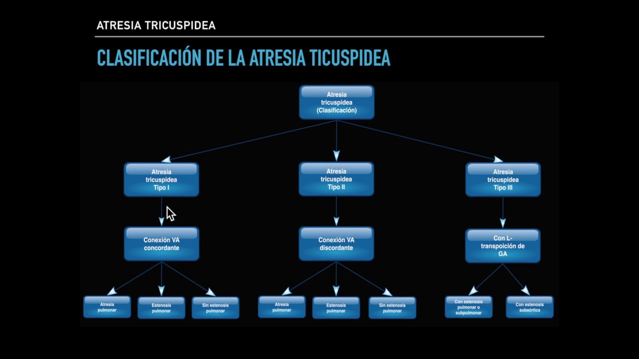 Atresia tricuspidea Clase Demo