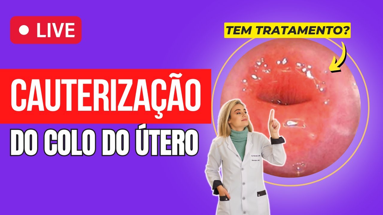 Cauterização de colo de útero  - Tratamento da feridinha colo do útero
