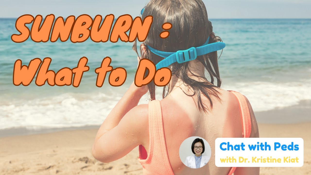 SUNBURN: What to do | How to take care of skin in SUMMER | Dr. Kristine Alba Kiat | Chat with Pets