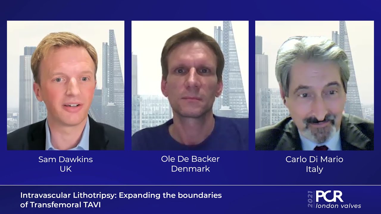 Intravascular Lithotripsy: Expanding the boundaries of Transfemoral TAVI - PCR London Valves 2021