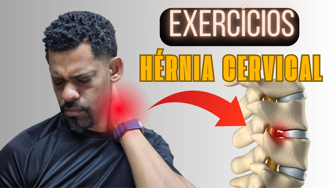 Hérnia de Disco Cervical: Exercícios para Aliviar Dor no Pescoço e Formigamento nos Braços