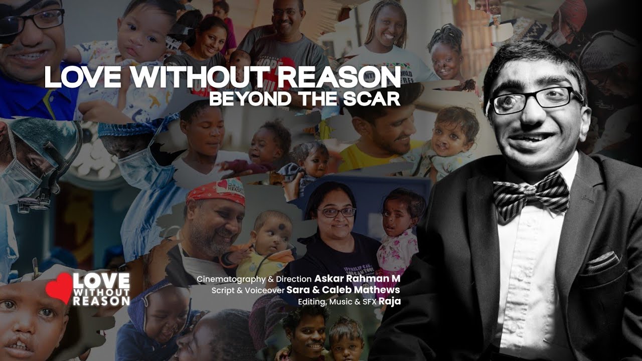 Love Without Reason: Beyond the Scar | Philip Mathews