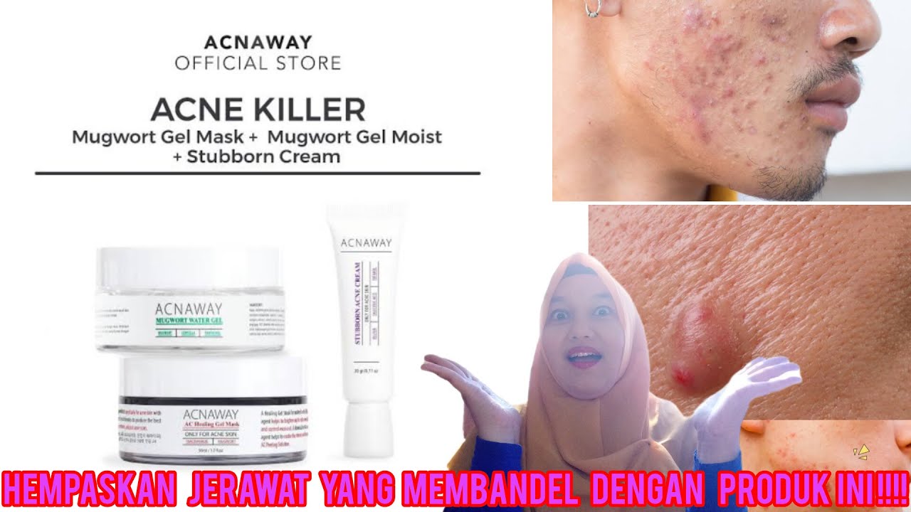Acnaway Skincare Hilangkan Jerawat Membandel|Kulit Acne Prone Boleh Mencoba??