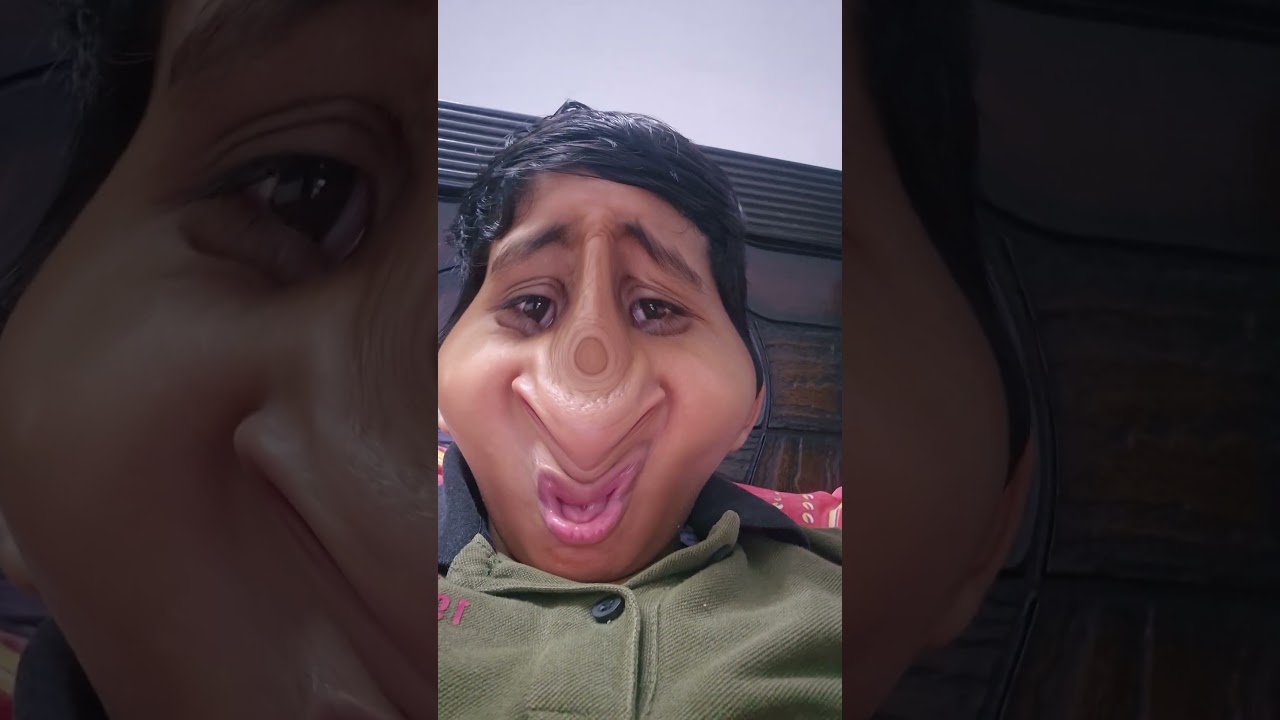 what happened to me|| #trending#nosetotail
