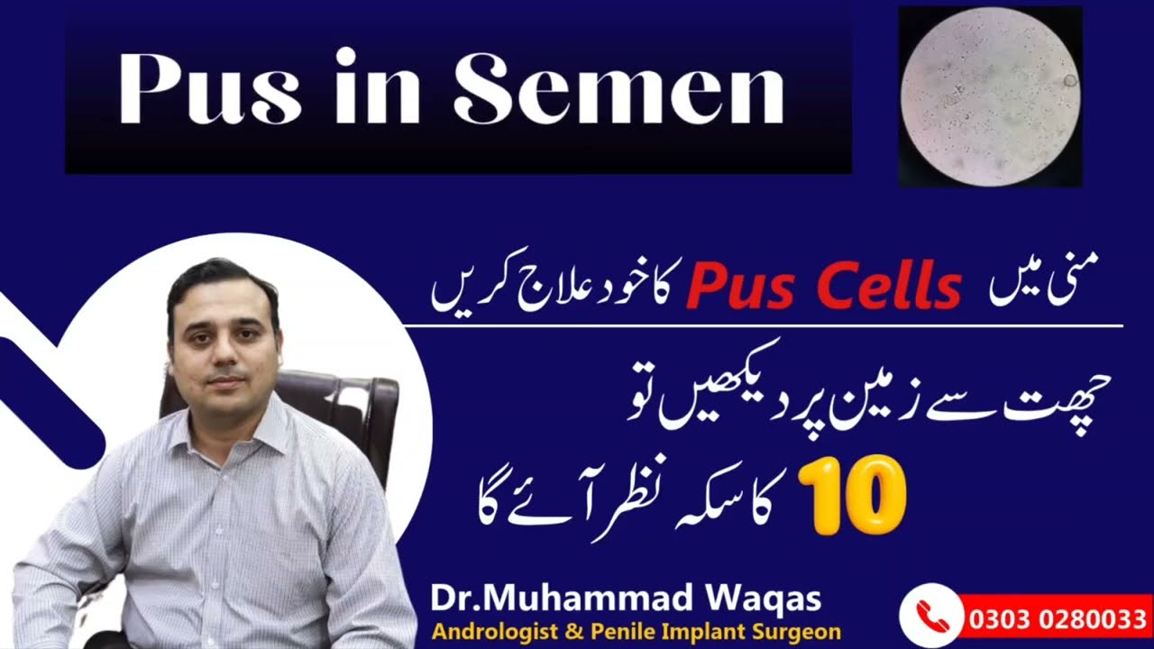 Pus cells in Sperm | Semen test Report in Urdu | Semen test at home| Pus cells in Semen Treatment |